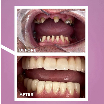 Slider image (5) Dent Antalya